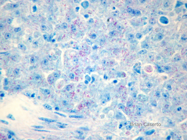 Granulomatous enteritis in a Parrot- Mycobacterium genavense